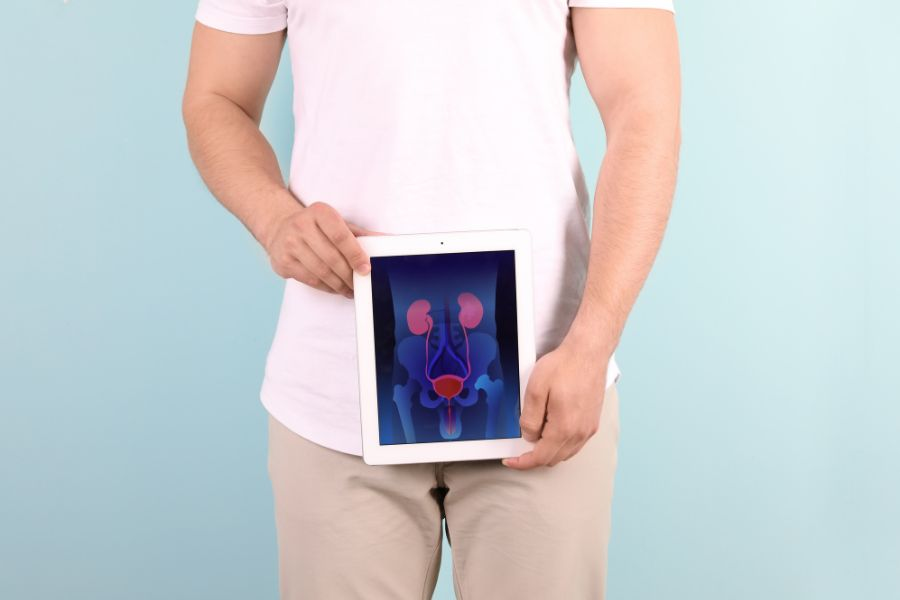 a man holding an x-ray image over his body